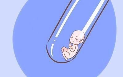 体外受精 IVF-ET